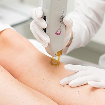 Hair Removal for Women Palm Beach Gardens