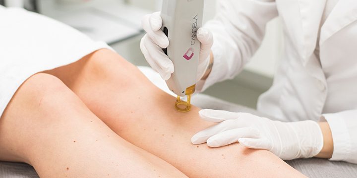 Hair Removal for Women Palm Beach Gardens