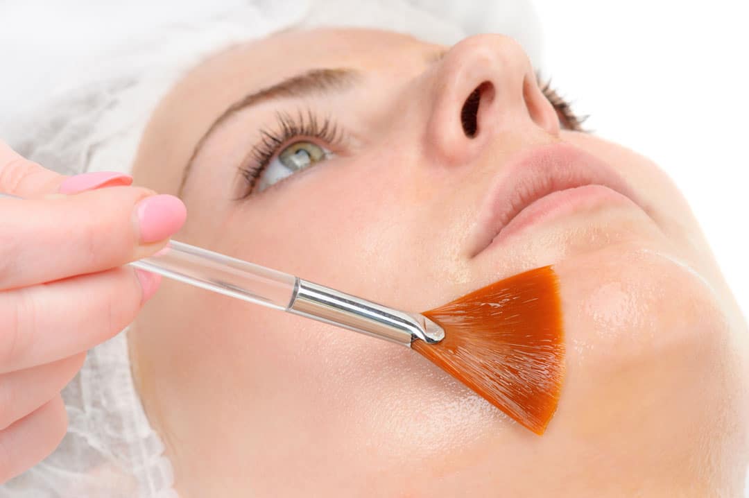 Chemical Peel Chemical Peel
