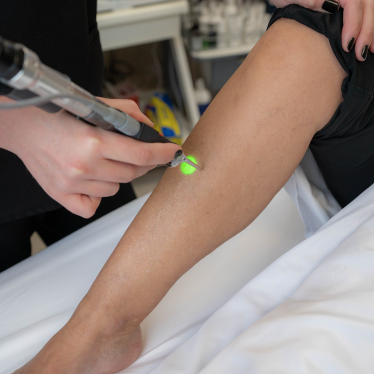 Laser Hair Removal Near Me