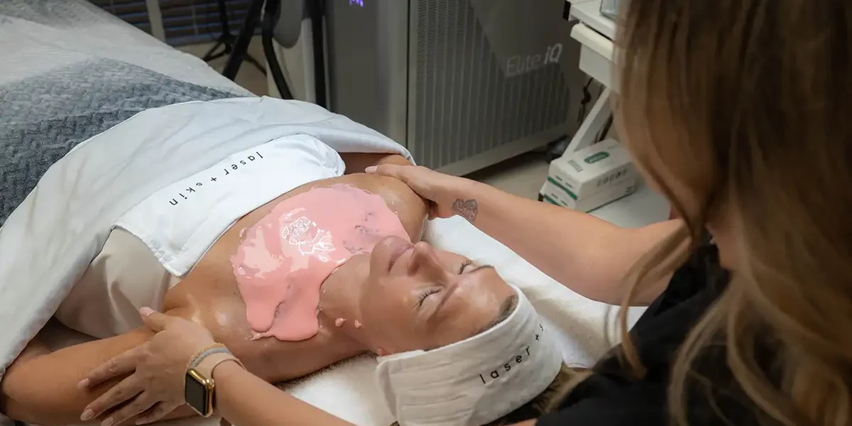 Chemical Peel Before and After, Chemical Peel Near Me Palm Beach Gardens