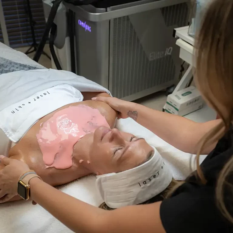 Chemical Peel Before and After, Chemical Peel Near Me Palm Beach Gardens