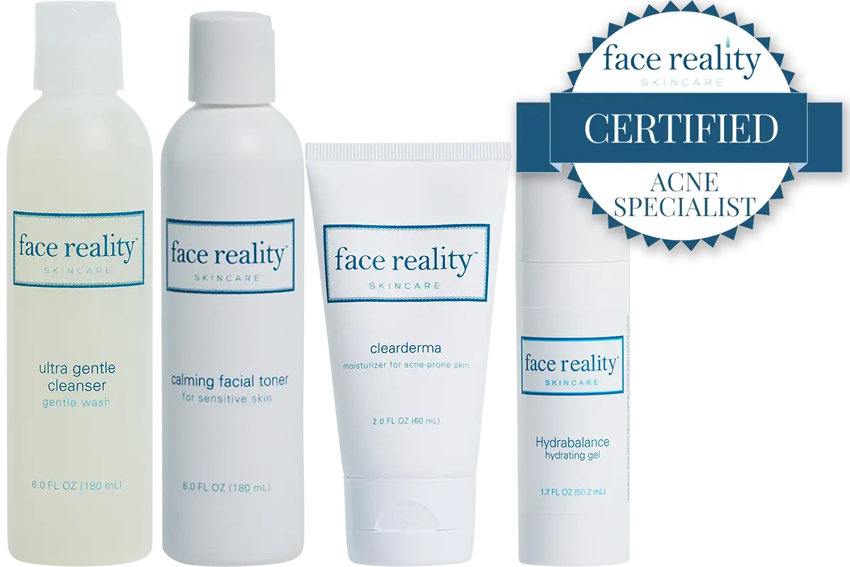 Best Acne Treatment for Teens