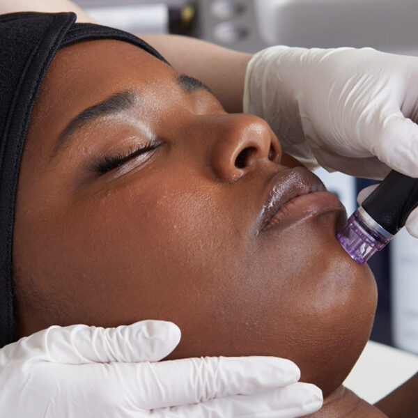 Hydrafacial Near Me, Hydrafacial Near Me, Hydrafacial Palm Beach Gardens, Hydrafacial Before and After