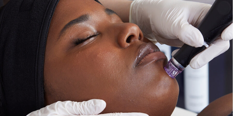 Hydrafacial Near Me, Hydrafacial Near Me, Hydrafacial Palm Beach Gardens, Hydrafacial Before and After