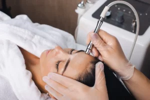 Microdermabrasion near me