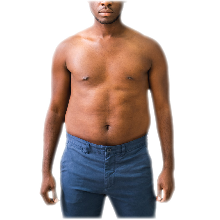 iShape_Before-and-After_NEW-07