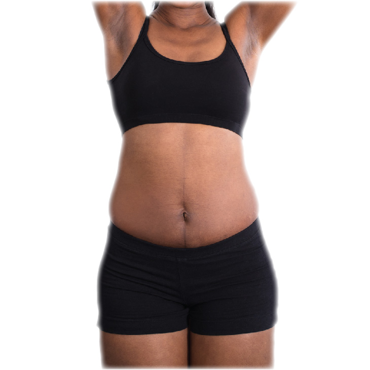 iShape_Before-and-After_NEW-19