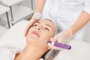 Microneedling Near Me