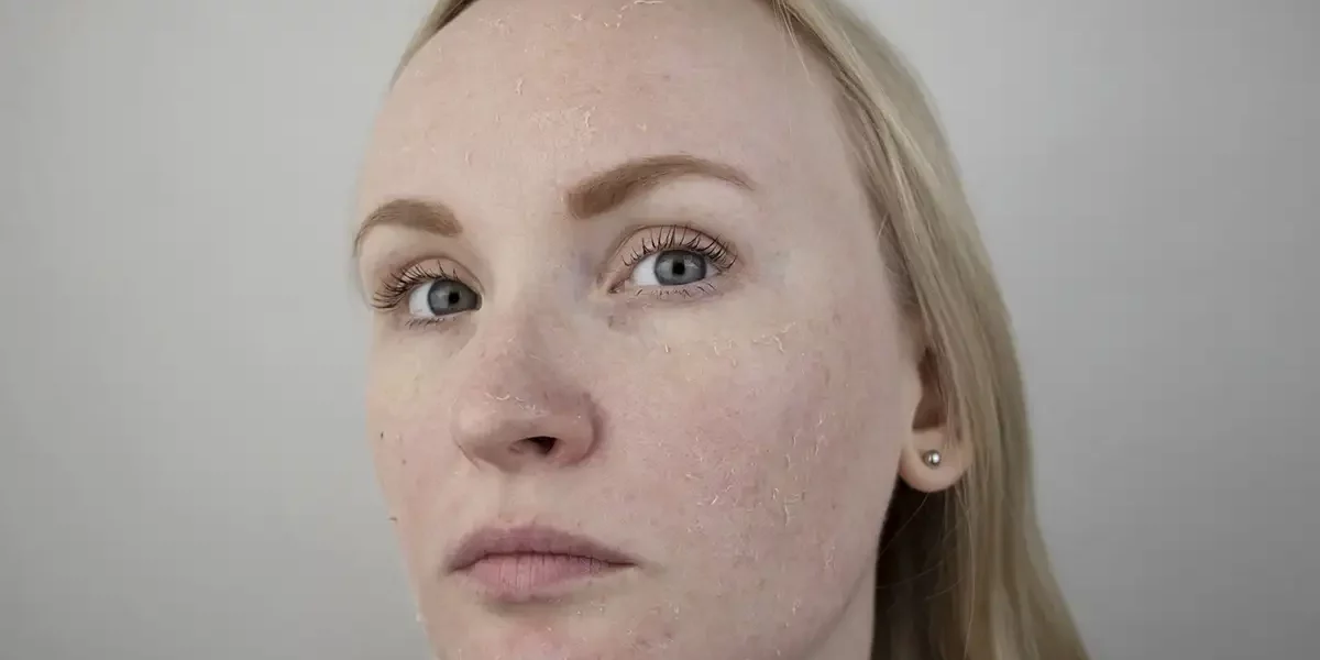 Dry Skin Treatment Palm Beach Gardens