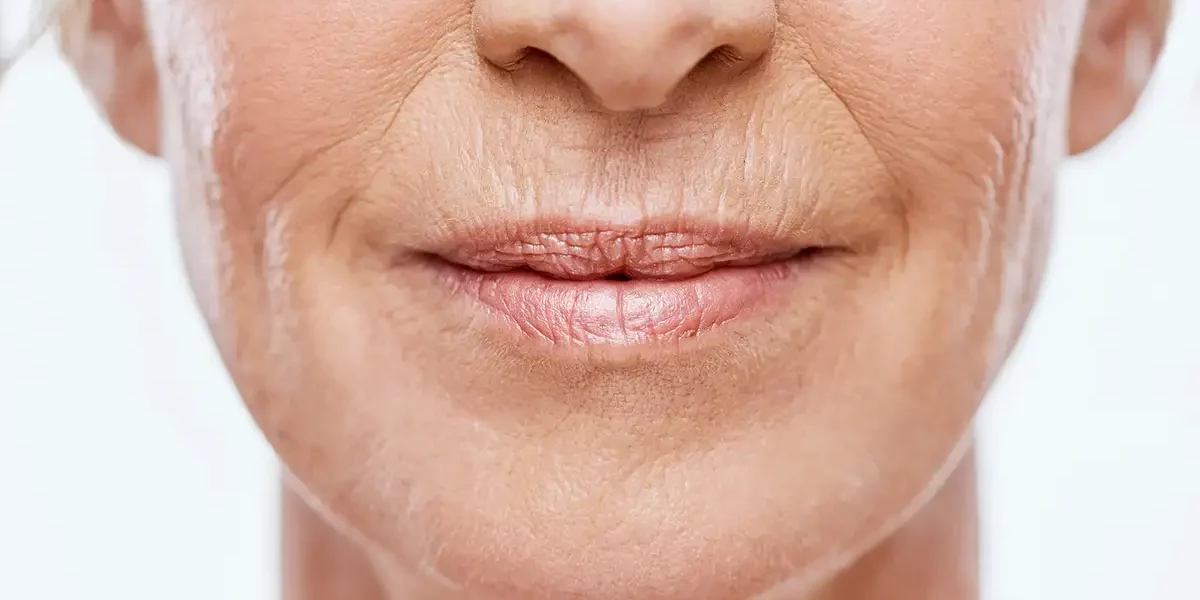 Wrinkles Treatment Palm Beach Gardens