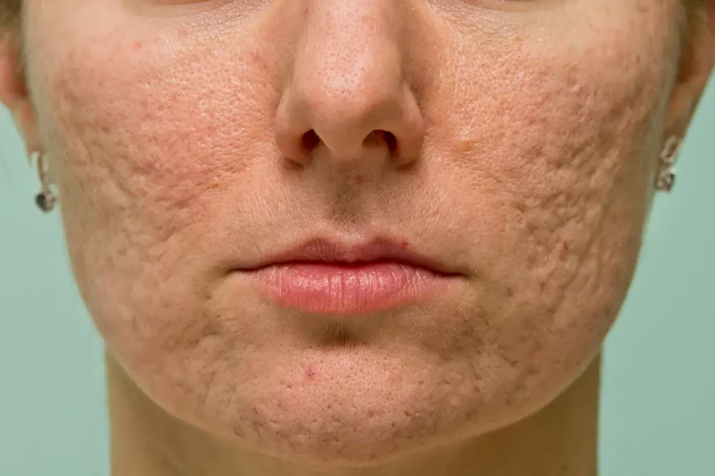 Textured Skin