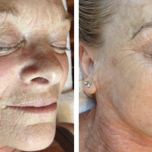 DMK Enzyme Therapy Palm Beach Gardens