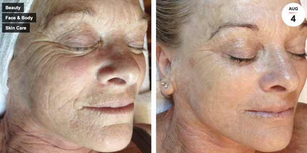 DMK Enzyme Therapy Palm Beach Gardens