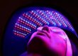 Red Light Therapy Near Me, Red Light Therapy Before and After