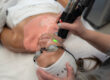 IPL Photofacial, IPL Photofacial Before and After