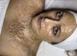 DMK Enzyme Therapy Near Me, DMK Enzyme Therapy Before and After