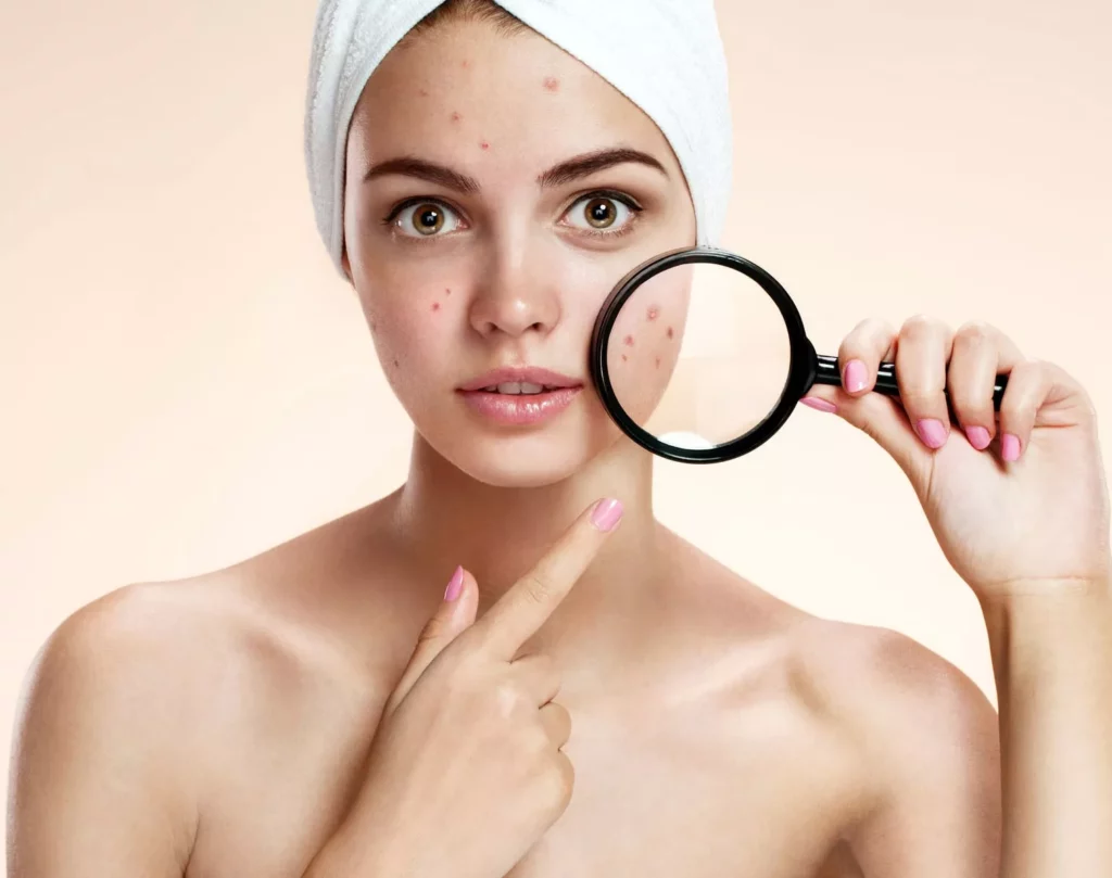 Reliable acne treatment Palm Beach Gardens options