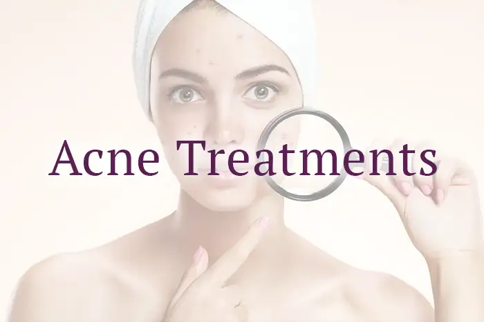 Best acne treatment in West Palm Beach, FL