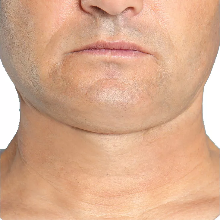 Non-invasive Jupiter light therapy treatments