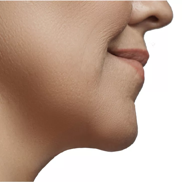 Palm Beach Gardens after body contouring​