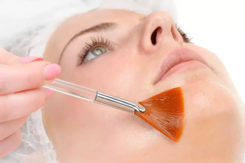 Chemical peels West Palm Beach skincare experts recommend