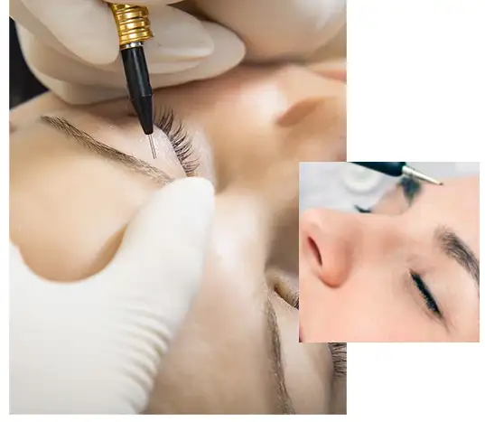 Electrolysis Jupiter FL services